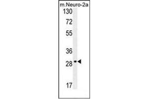 Western blot analysis of OR9Q1 Antibody (C-term) in mouse Neuro-2a cell line lysates (35ug/lane). (OR9Q1 antibody  (C-Term))