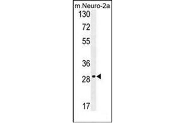 OR9Q1 anticorps  (C-Term)