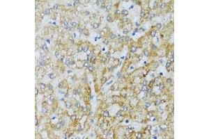Immunohistochemistry of paraffin-embedded human liver using C1QC antibody (ABIN7266475) at dilution of 1:100 (40x lens).