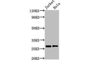 Western Blot Positive WB detected in: Jurkat whole cell lysate, Hela whole cell lysate All lanes: HSD17B10 antibody at 3 μg/mL Secondary Goat polyclonal to rabbit IgG at 1/50000 dilution Predicted band size: 27, 26 kDa Observed band size: 27 kDa (HSD17B1 antibody  (AA 2-261))