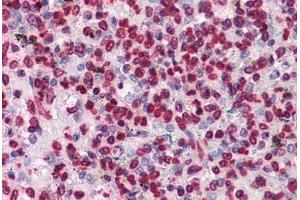 Human Spleen: Formalin-Fixed, Paraffin-Embedded (FFPE) (HIPK1 antibody  (AA 330-430))