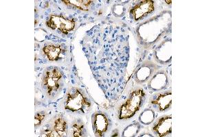 Immunohistochemistry of paraffin-embedded human kidney using [KO Validated]  Rabbit mAb  at dilution of 1:100 (40x lens). (ACE2 antibody)