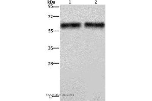 Western blot analysis of Human hepatocellular carcinoma tissue, using ELN Polyclonal Antibody at dilution of 1:400 (Elastin antibody)