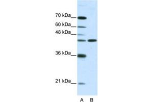 Western Blotting (WB) image for anti-Neuromedin U Receptor 2 (NMUR2) antibody (ABIN2461125) (NMUR2 antibody)