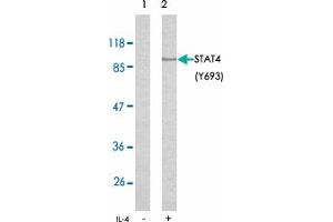 Western blot analysis of extracts from HeLa cells using STAT4 (phospho Y693) polyclonal antibody . (STAT4 antibody  (pTyr693))