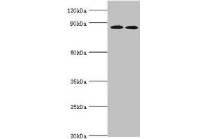 Western blot All lanes: AMP deaminase 3 antibody at 2 μg/mL Lane 1: NIH/3T3 whole cell lysate Lane 2: 293T whole cell lysate Lane 3: Mouse lung tissue Secondary Goat polyclonal to rabbit IgG at 1/10000 dilution Predicted band size: 89, 25, 77, 90, 72 kDa Observed band size: 89 kDa (AMPD3 antibody  (AA 1-260))