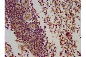 IHC image of ABIN7145780 diluted at 1:100 and staining in paraffin-embedded human spleen tissue performed on a Leica BondTM system. (BIN2 antibody  (AA 290-496))