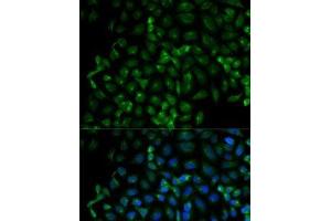Immunofluorescence analysis of HeLa cells using Beta-TRCP Polyclonal Antibody (beta-TrCP antibody)