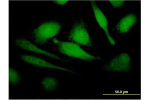 Immunofluorescence of monoclonal antibody to HBXIP on HeLa cell. (HBXIP antibody  (AA 83-173))