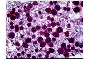 Immunohistochemistry (IHC) image for anti-Fatty Acid Desaturase 1 (FADS1) (AA 1-100) antibody (ABIN782376) (FADS1 antibody  (AA 1-100))