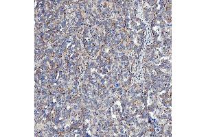 IHC analysis of SFXN5 using anti-SFXN5 antibody (ABIN7601388). (Sideroflexin 5 antibody  (AA 34-340))