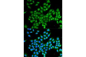 Immunofluorescence analysis of MCF-7 cells using DAO antibody (ABIN5973055).