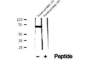 Western blot analysis of extracts of human skeletal muscle tissue, using FAM65B antibody. (FAM65B antibody)