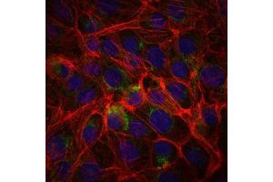 Immunofluorescence analysis of PC-2 cells using CD15 mouse mAb (green). (CD15 antibody)