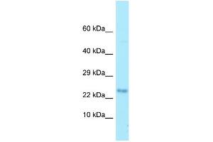 Western Blotting (WB) image for anti-Myelin Associated Oligodendrocyte Basic Protein (MOBP) (N-Term) antibody (ABIN2789776)