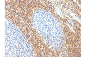 Formalin-fixed, paraffin-embedded human Tonsil stained with CD52 Rabbit Recombinant Monoclonal Antibody (CD52/2276R). (Recombinant CD52 antibody)