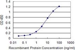 Detection limit for recombinant GST tagged ULK2 is 0. (ULK2 antibody  (AA 743-843))