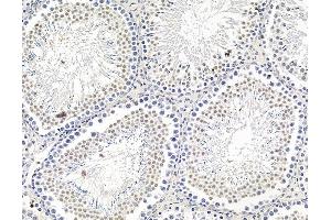 ABIN7095832 and ABIN7099894 at 1/100 staining rat testis tissue by IHC-P. (ARID5A antibody)