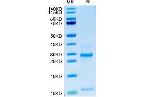 NOTCH3 Protein (AA 1378-1640) (His tag)