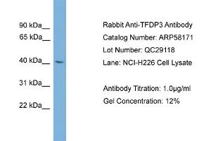 WB Suggested Anti-TFDP3  Antibody Titration: 0. (TFDP3 antibody  (Middle Region))