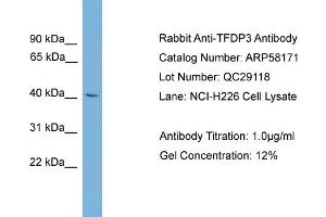 WB Suggested Anti-TFDP3  Antibody Titration: 0.