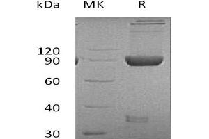 Western Blotting (WB) image for Lymphocyte-Activation Gene 3 (LAG3) protein (Fc Tag) (ABIN7320947) (LAG3 Protein (Fc Tag))
