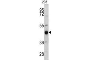Western blot analysis of KRT13 antibody (N-term) in 293 cell line lysates (35ug/lane). (Cytokeratin 13 antibody  (N-Term))