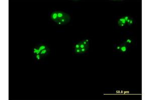 Immunofluorescence of purified MaxPab antibody to GNL3 on HeLa cell. (Nucleostemin antibody  (AA 1-549))