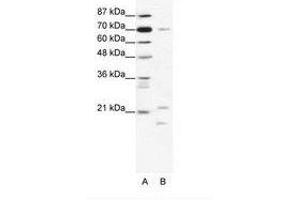 Image no. 1 for anti-Basic Transcription Factor 3 (BTF3) (C-Term) antibody (ABIN203029) (BTF3 antibody  (C-Term))