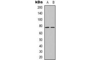 Western blot analysis of Transferrin expression in Hela (A), HEK293T (B) whole cell lysates. (Transferrin antibody  (C-Term))