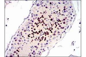 Immunohistochemical analysis of paraffin-embedded human testis tissues using CDK4 mouse mAb with DAB staining.