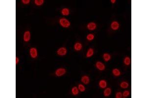 ABIN6268972 staining HeLa by IF/ICC. (Cyclin H antibody  (pThr315))