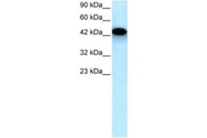 Western Blotting (WB) image for anti-Eyes Absent Homolog 3 (EYA3) antibody (ABIN2460428) (EYA3 antibody)