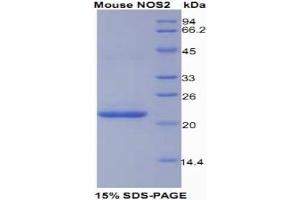 SDS-PAGE of Protein Standard from the Kit (Highly purified E. (NOS2 ELISA Kit)