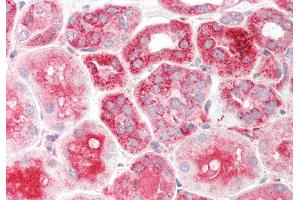Rabbit Anti-TXN2 antibody Catalog Number: ARP54909 Formalin Fixed Paraffin Embedded Tissue: Human Kidney Primary antibody Concentration: 1:100 Secondary Antibody: Donkey anti-Rabbit-Cy3 Secondary Antibody Concentration: 1:200 Magnification: 20x Exposure Time: 0. (TXN2 antibody  (Middle Region))