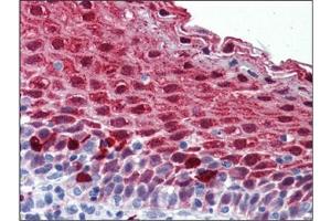 Human Tonsil: Formalin-Fixed, Paraffin-Embedded (FFPE) (MARK4 antibody  (Internal Region))