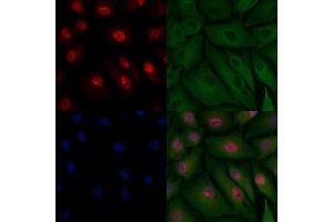 ABIN6262242 and ABIN6278080 staining  cells by IF/ICC. (HIPK2 antibody  (N-Term))
