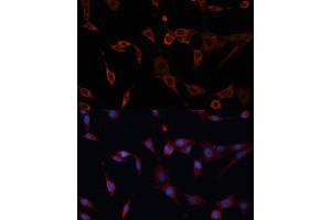 Immunofluorescence analysis of NIH/3T3 cells using PDI antibody (ABIN6128422, ABIN6145387, ABIN6145388 and ABIN6216541) at dilution of 1:100. (PDIA2 antibody  (AA 326-525))