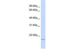 Image no. 1 for anti-TGFB-Induced Factor Homeobox 2-Like, Y-Linked (TGIF2LY) (AA 107-156) antibody (ABIN6741775) (TGIF2LY antibody  (AA 107-156))