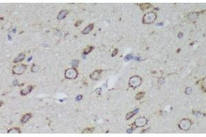 Immunohistochemistry of paraffin-embedded Rat brain using PSAP Polyclonal Antibody at dilution of 1:200 (40x lens). (Prosaposin antibody)
