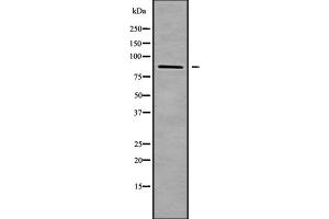 Western blot analysis of ZNF839 using HUVEC whole cell lysates (ZNF839 antibody  (Internal Region))