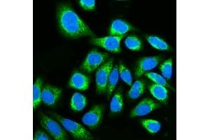 IF analysis of Kinectin 1/KTN1 using anti-Kinectin 1/KTN1 antibody (ABIN7601096). (KTN1 antibody  (AA 283-827))