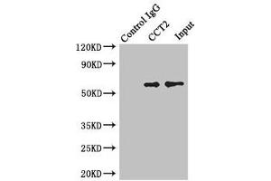 Immunoprecipitating CCT2 in Jurkat whole cell lysate Lane 1: Rabbit control IgG instead of (1 μg) instead of ABIN7171416 in Jurkat whole cell lysate. (CCT2 antibody  (AA 206-535))