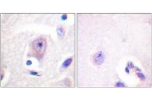 Immunohistochemistry analysis of paraffin-embedded human brain tissue, using CDC6 (Ab-54) Antibody. (CDC6 antibody  (AA 20-69))