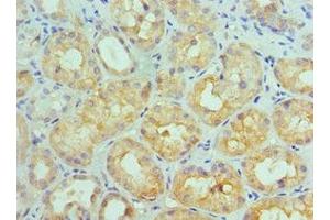 Immunohistochemistry of paraffin-embedded human kidney tissue using ABIN7156772 at dilution of 1:100 (IL11RA antibody  (AA 30-290))