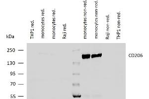 Western blotting analysis of human CD206 using mouse monoclonal antibody 15-2 on lysates of differentiated monocytes (two batches), and on THP-1 and Raji cells (negative controls) under reducing and non-reducing conditions. (Macrophage Mannose Receptor 1 antibody)