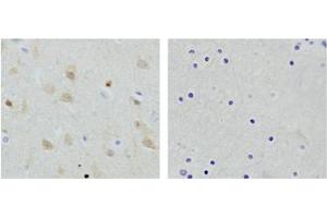 Immunohistochemistry analysis of human brain tissue slide (Paraffin embedded) using Rabbit Anti-NSE Polyclonal Antibody (Left, ABIN398879) and Purified Rabbit IgG (Whole molecule) Control (Right, ABIN398653) (ENO2/NSE antibody  (N-Term))