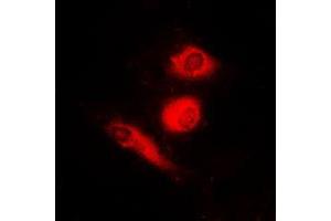 Immunofluorescent analysis of FOXO4 (pS197) staining in HeLa cells. (FOXO4 antibody  (pSer197))