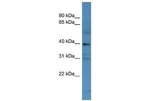 MAGEC2 antibody used at 0. (MAGEC2 antibody  (N-Term))