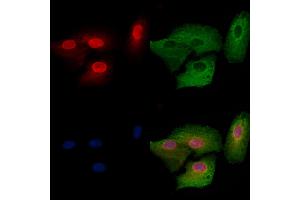 ABIN6264999 and ABIN6278724 staining  cells by IF/ICC.
